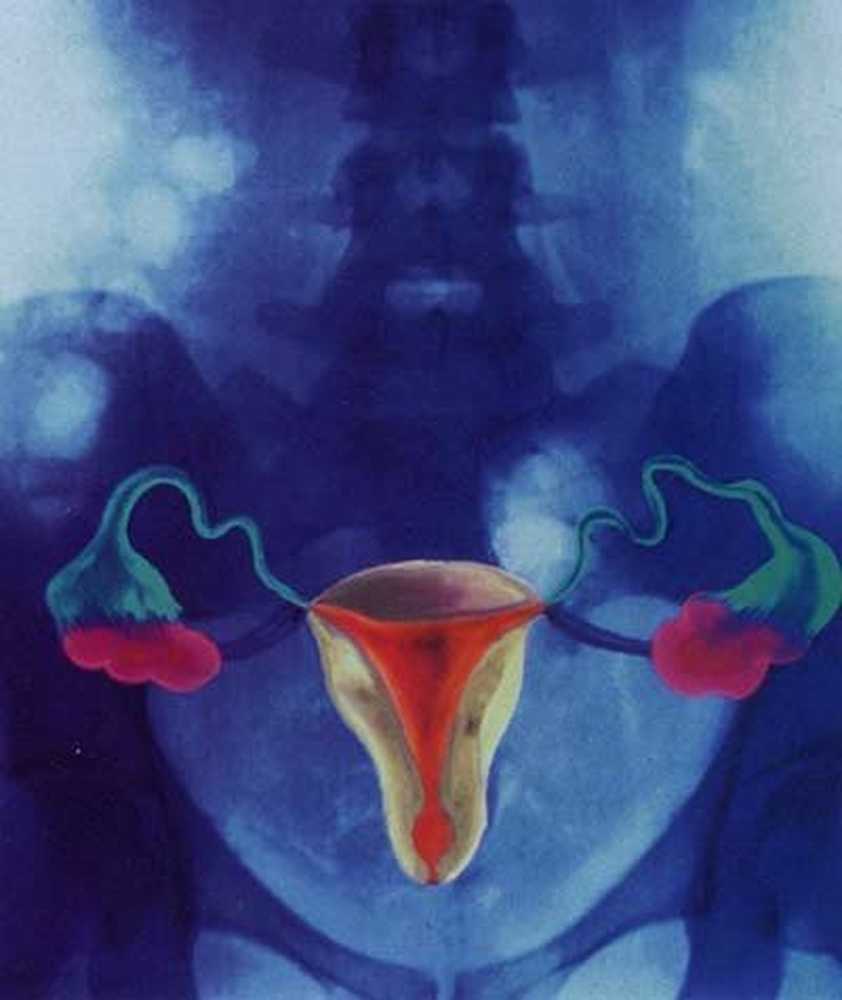 Диагностика заболеваний женских половых органов. Бактериальный вагиноз цервицит. Воспаление фаллопиевых труб.