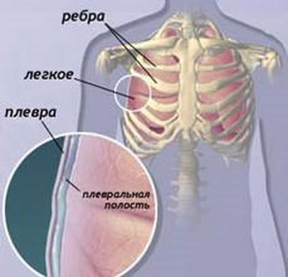 Плевральная полость образована