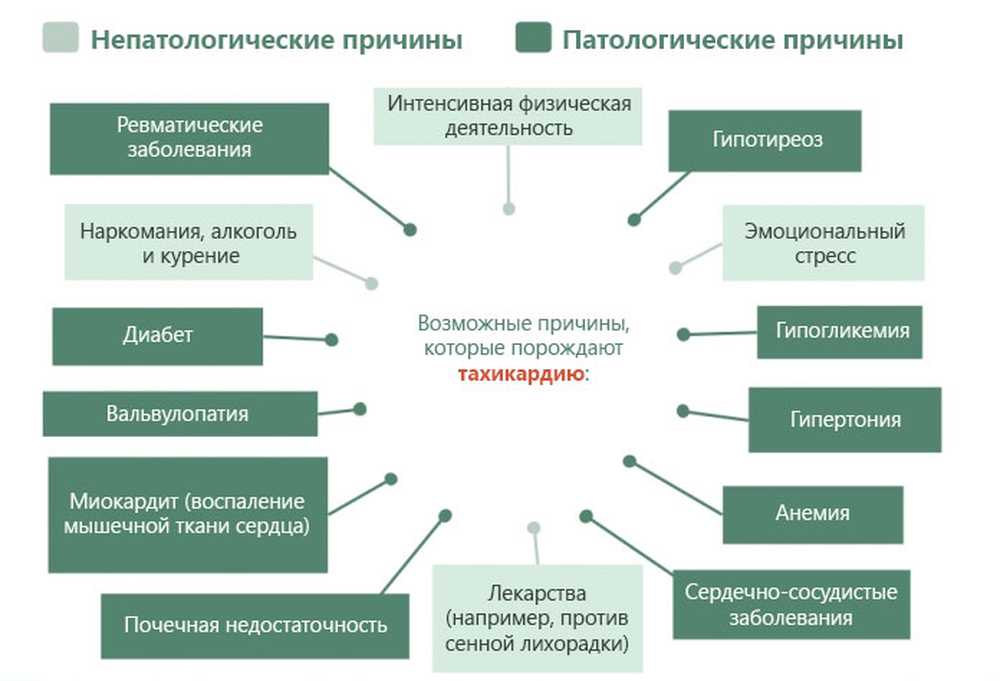 Резко сильное сердцебиение