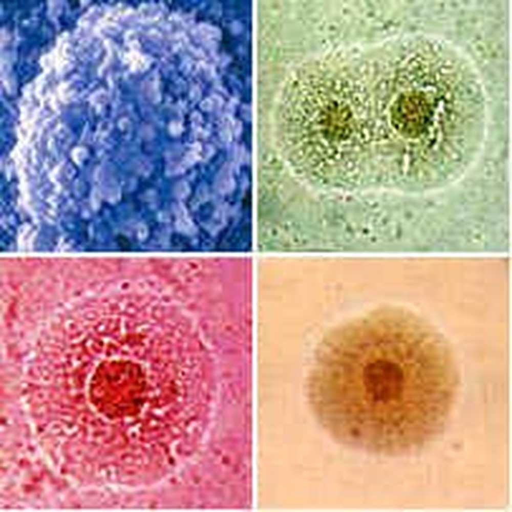 Chlamydia trachomatis mycoplasma genitalium. Микоплазмоз, уреаплазмоз, хламидиоз. Микоплазма уреалитикум.
